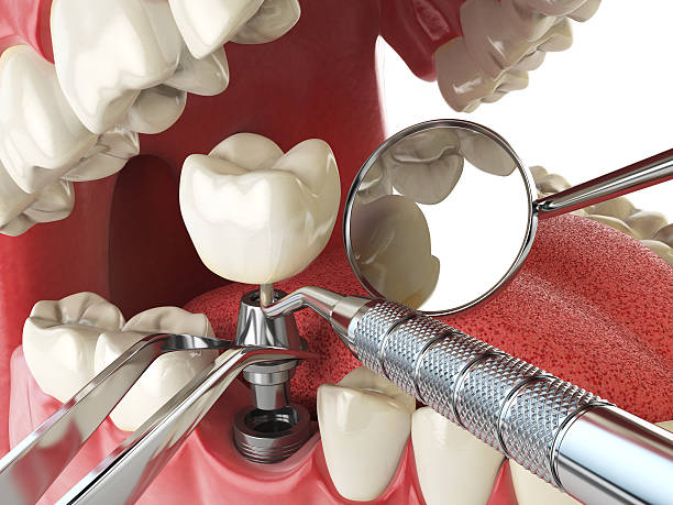 Best Emergency Root Canal Therapy in New Brockton, AL